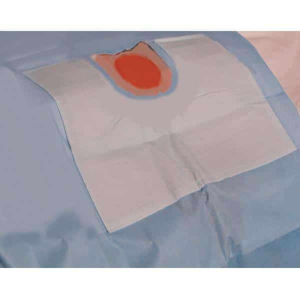 D-120 LeadFree™ Brachail Drape 12"x17"